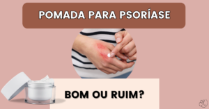 Mão com lesões de psoríase sendo tratada com pomada, ao lado de um pote de creme