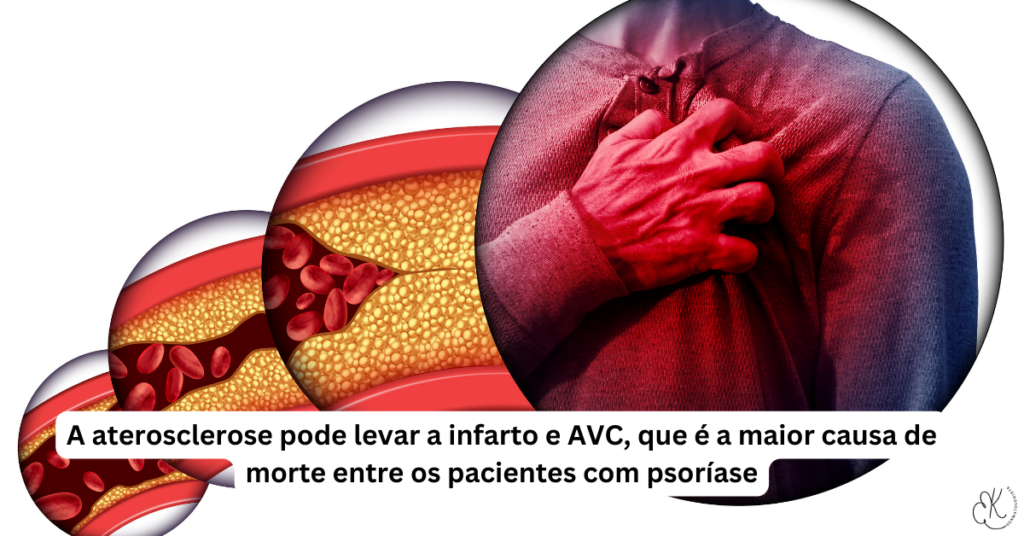 Artéria com placas de gordura e homem com dor no peito