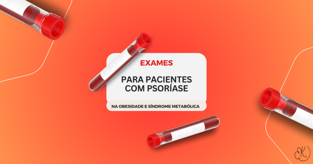 Psoríase e exames essenciais: A Importância do Acompanhamento da Obesidade e Síndrome Metabólica