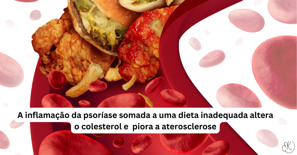 Imagem de alimentos ultraprocessados com glóbulos vermelhos