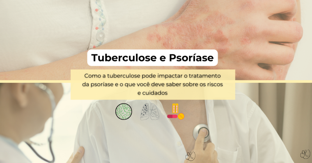 Psoríase e Tuberculose: O Que Você Precisa Saber
